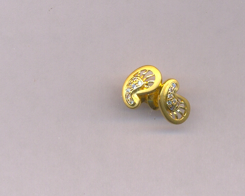 GOLD TOP CASTING FANCY